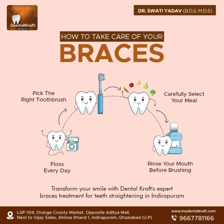 Best Braces Treatment for Teeth Straightening in Indirapuram  