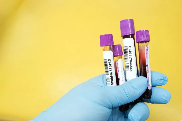 Ferritin Test in Delhi