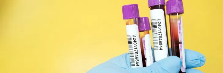 Ferritin Test in Delhi