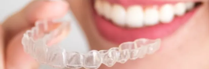 Invisible braces specialist in bangalore 